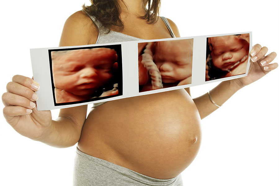 HD Ultrasound