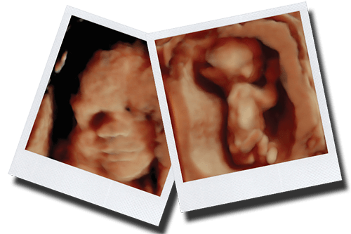 HD Live Ultrasound